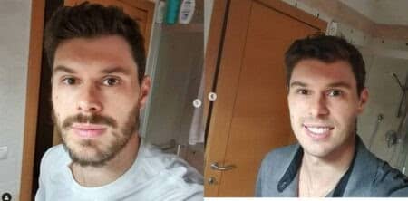 Bruninho, jogador da Seleção Brasileira de vôlei, tirou a barba por causa do coronavírus.